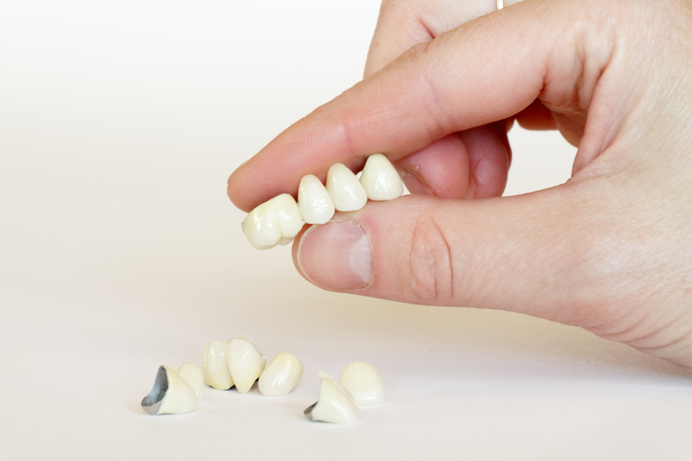 Dental Crowns